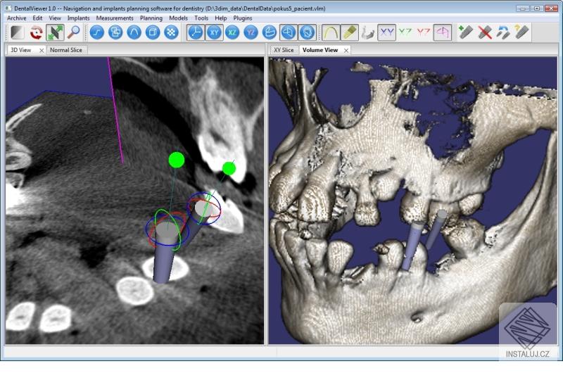 DentalViewer