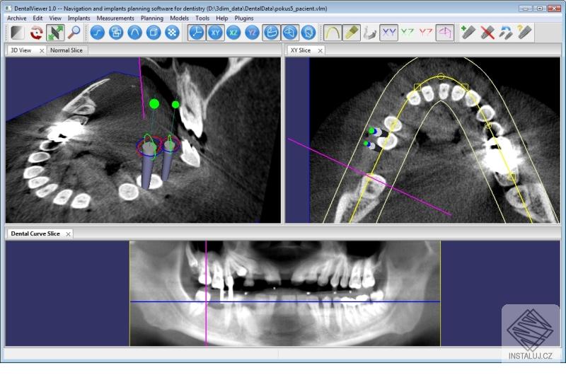 DentalViewer