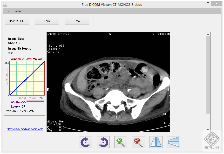 Free DICOM Viewer