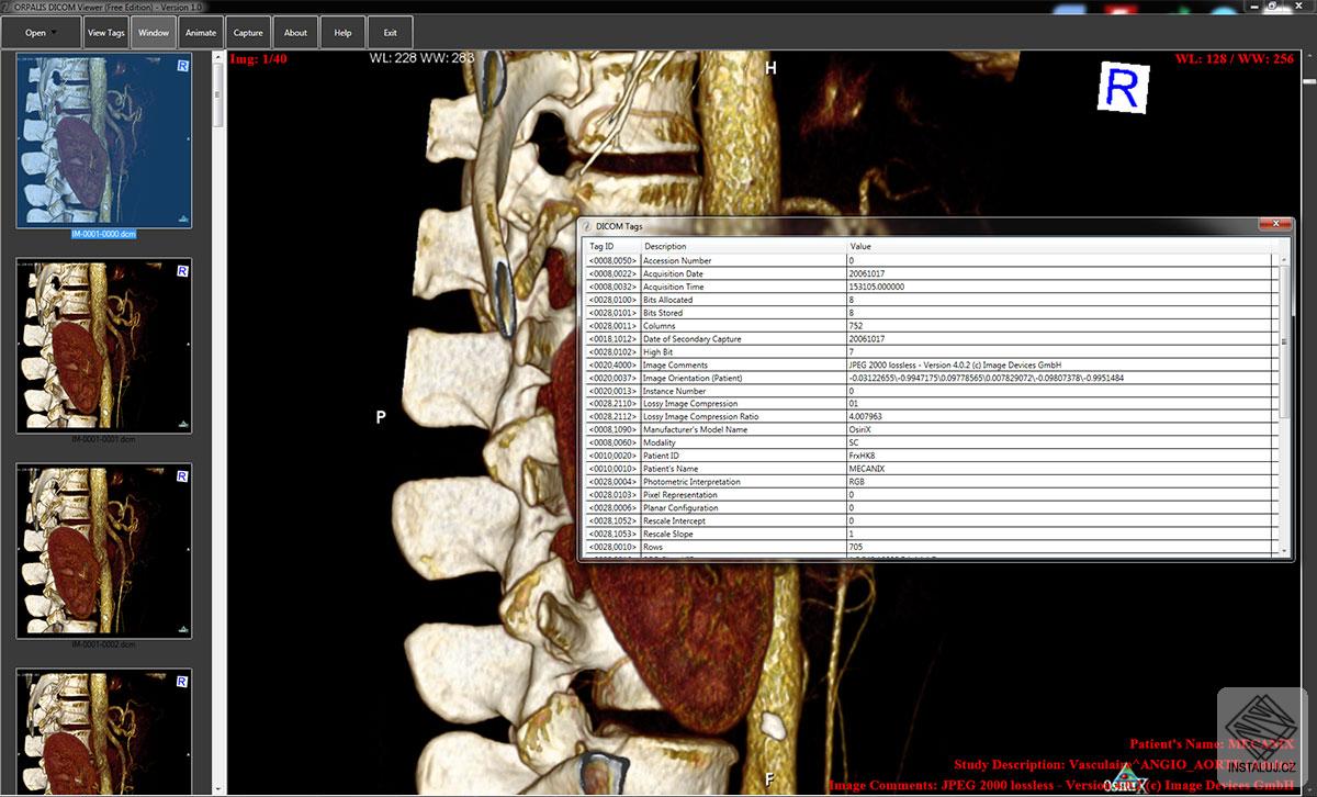 ORPALIS DICOM Viewer