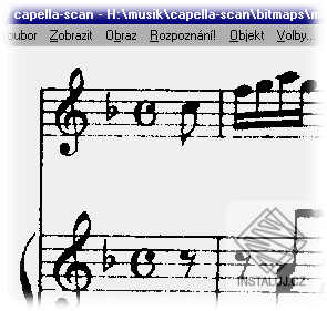 Capella SCAN