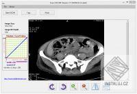 Free DICOM Viewer